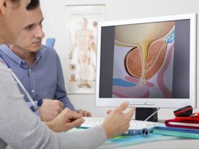 Un urologue consulte un patient au sujet de problèmes de puissance.